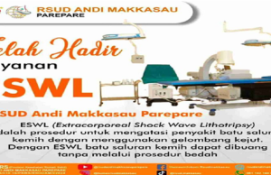 RSUD Andi Makkasau Parepare Hadirkan Layanan ESWL, Solusi Tangani Batu Ginjal Tanpa Operasi